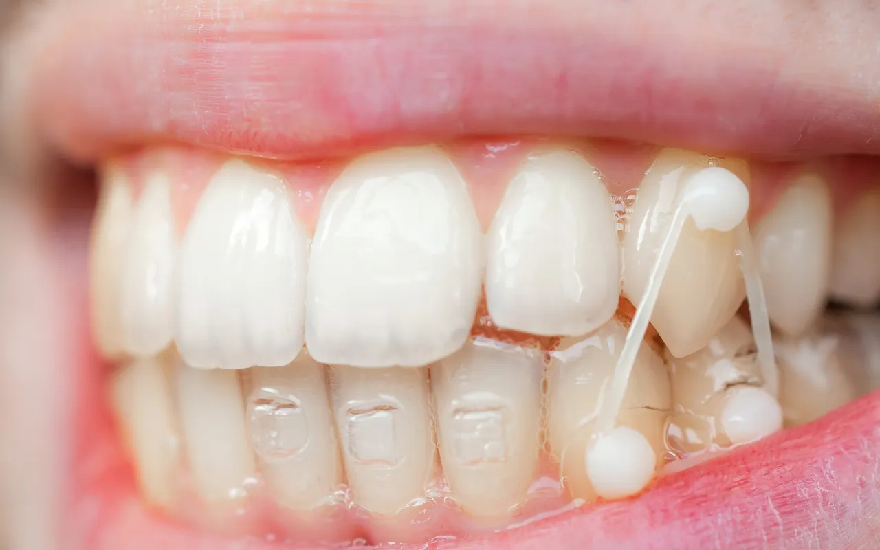 噛み合わせの管理