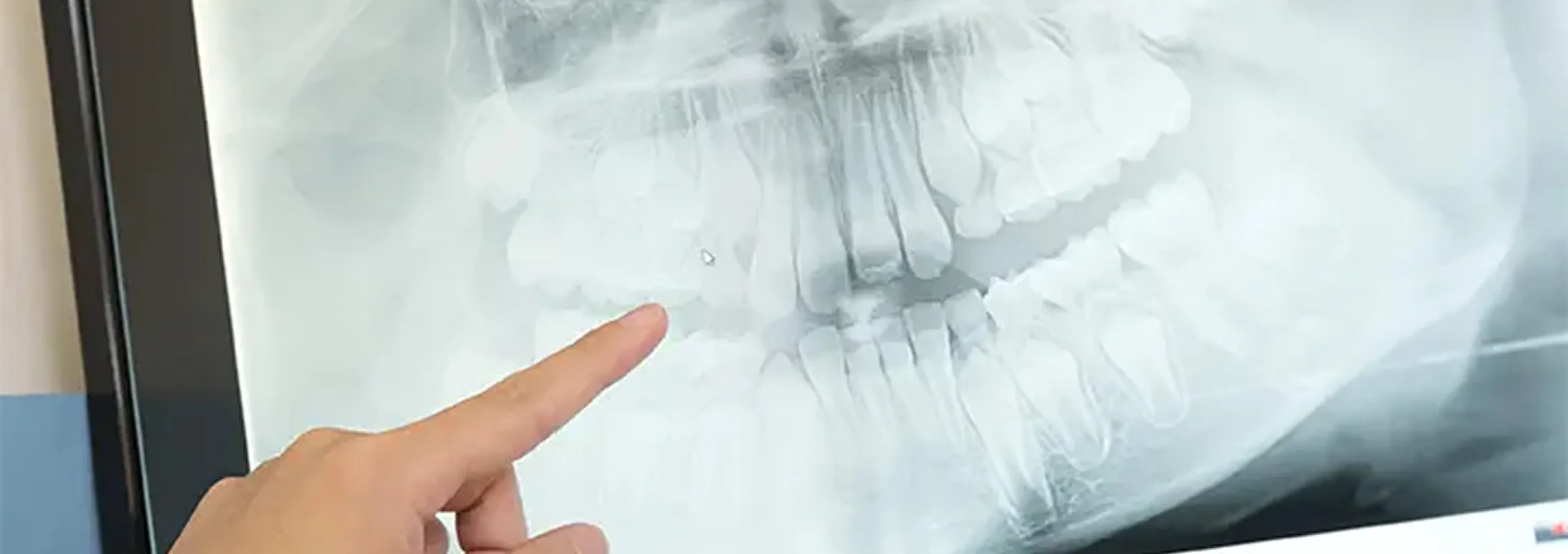 保険適用の顎変形症治療が可能