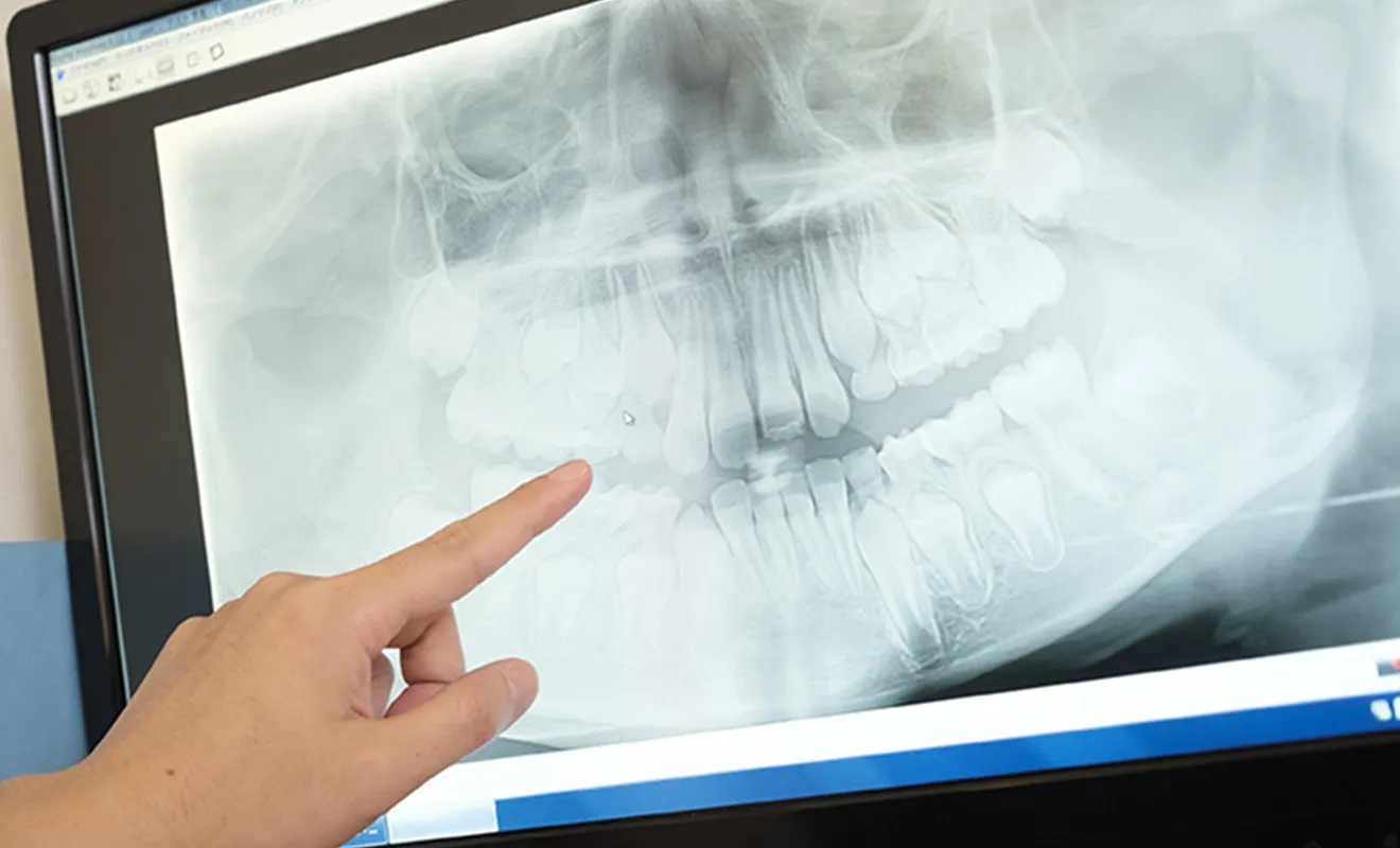 保険適用の顎変形症治療が可能